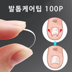 발톱관리 발톱케어팁 케어밴드 (단품/세트), 발톱케어팁 100p