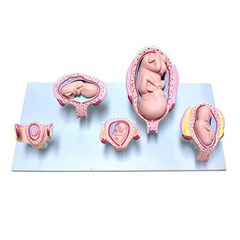 태아발달모형 5단계 태아성장모형 성교육교구 KIM-M0013-2