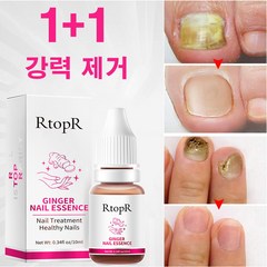 유오노미 독일 1+1 손발톱 발톱 관리 네일, 5개, 10ml