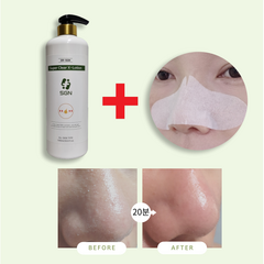 [에스지엔바이오] Dr.SGN 슈퍼클리어엑스로션 300ml 슈퍼엑스로션 대용량 1000ml 피지연화제 코 블랙헤드 모공케어 저자극성 블랙헤드제거액 로션엑스