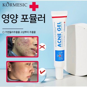 [약국 직판]KORMESIC여드름 연고 민감한 피부를 위한 첫 번째 미국 FDA 인증 브랜드 획득 여드름 빨리 없애세요 수리 장벽 여드름 자국 여드름 흉터W009, 1개, 30ml