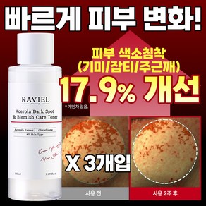 라비엘 아세로라 잡티 앤 기미 케어 토너, 3개, 150ml