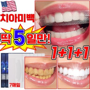 [국내배송] 미국 1/1+1/2+2 치아 미백 패치 셀프 치아미백 제 화이트닝 얼룩 제거 스티커, 3세트, 26g