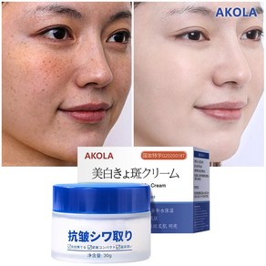 AKOLA 30g 기미제거크림 검버섯제거크림 색소침착 개선 미백 크림 수분 크림