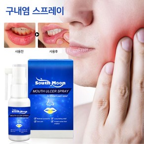 SM 빠르고 효과적인 완화 잇몸 염증 치주 부기 치주 물집 치통스프레이 JYT-5, 2개, 30ml