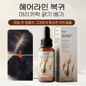 로즈마리 헤어 에센스 두피 영양제 헤어 에센스 영양케어 퓨어 네이처 성장 모발 오일 갈라진 모발케어 두피 가려움증 및 건조함, 2개, 30ml