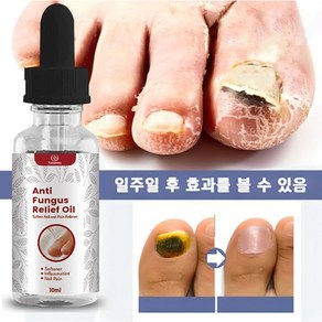 발톱 무좀 케어 손톱진균 발톱무좀 큐티클 트리트먼트 에센스