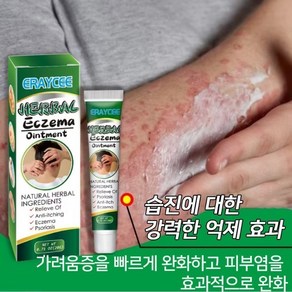 {일본 수입 국내 배송} 천연 순수 식물 추출물 습진 연고비늘 습진 완화두드러기가려운 피부헤르페스건성 피부알레르기 물집등, 2개, 20g