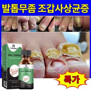 발톱무좀 조갑사상균증 발톱 관리 손톱 영양제, 2개, 30ml