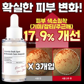 RAVIEL 아세로라 잡티 앤 기미 케어 앰플, 30ml, 3개