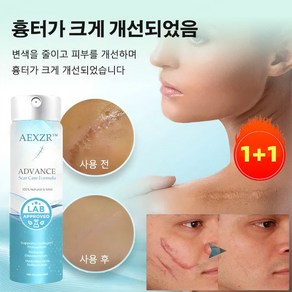 1+1 흉터 제거 스프레이 흉터제거연고 흔적 개선 흉터 제거, 20ml, 2개