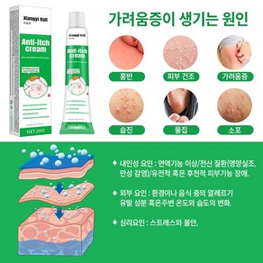 [치료 효과99.99%]두드러기건선완선사타구니습진소양증피부가려움연고YY003, 2개, 20g