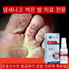 [정품 일본제품/당일배송] 발냄새스프레이/발냄새 땀 갈라진 피부 물집 가려움 이상한 냄새/가벼운 스프레이 하나로 발 문제 해결/QQ07, 1개, 30ml