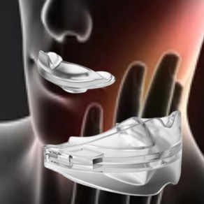 메디슬립 이갈이 차단 습관 방지 기구 효과보장형 턱관절 보호 치료 교정기 반영구적
