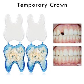 5pcs 치과 임시 치아 전방 후부 재료 액세서리 도구