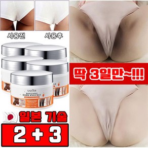 [일본 개발] 1/1+1 미백 크림 겨드랑이 색소침착 크림 멜라토닝 크림 사타구니/Y존/엉덩이/팔꿈치/무릎 미백 착색 크림 톤업 화이트닝 피부 케어 선물 랜덤 증정, 5개, 140g