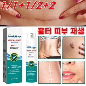 [국내배송] 상처 흉터 제거 피부 재생크림 제왕절개 수술흉터 화상 흉터 케어 미스트, 2개