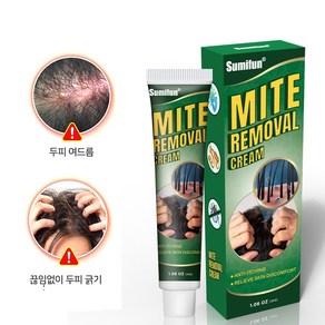 가려움증 두피 모낭염 가려움 방지 연고 20g S-38, 30ml, 2개