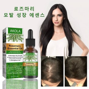 AKOLA [일일 혜택] 로즈마리 추출물 두피 토닉 탈모 예방 탈모 증상 완화 두피 영양 공급 모발 성장 촉진 두피 추출물 헤어 오일, 2개, 30ml