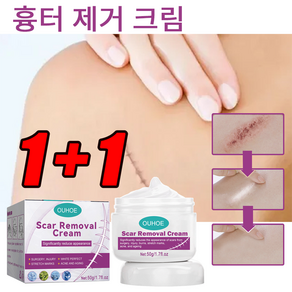 1+1 제거 흉터 제거 크림 흉터제거연고 흉터 관리 제거 수술 흉터 제거 크림, 2개, 50g