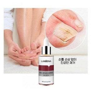 LANBENA 발톱무좀 진균 리페어에센스 조갑사상균증 손발톱 네일 리페어 에센스 15ml, 1개