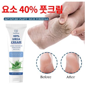 유레아크림 요소 40% 고보습 손-발 케어 겨울철 건조하고 거칠어진 수족개선/ 갈라진 주름완화/ 거칠어진 굳은살/각질제거 풋크림, 1개, 50ml