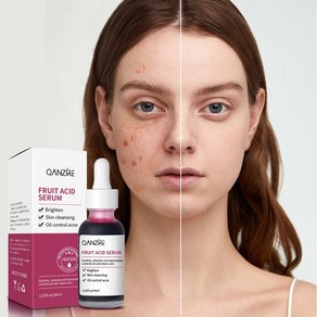 BEIBEI 모공 수축 피지녹이는제품 여드름 제거 1개 30ml, 2개