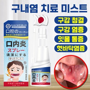 [빠른배송] 1+1+1/1 구내염약 잇몸통증 가글 미스트 항균 케어 만성염 구강청결제 혀 마르고 갈라짐 구내궤양 스프레이