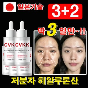 [일본기술] 1/1+1 저분자 히알루론산 콜라겐 앰플 주름개선 에센스 기미 미백 탄력 목주름 팔자주름 눈밑주름 케어 보습 광채 리프팅 안티에이징 앰플, 5개, 30ml