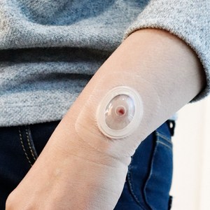 안다찌 상처보호캡 1세트 (방수필름 동봉), 소형, 5개