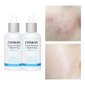 트러블 진정 자국 얼굴피지 모공 보습 광채 수분 에센스 50ml, 2개