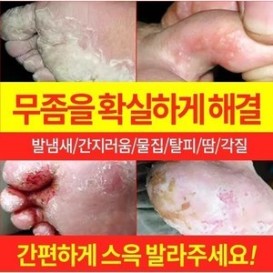 {국내 배송/일본 도쿄 R&D} 발 냄새를 빠르게 제거 / 무좀소독 / 가려움증 방지 및 살균 / 발 필링 / 발흘림 / 발흘림 / 물집 / 기타 발 관리, 2개, 20g