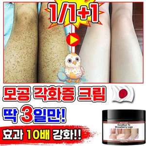[일본기술] 모공 각화증 닭살 피부 바디 크림 모공 각질 제거 바디 로션 고보습 다리 등 팔 피부 모공 각화 모낭염 개선 치료 피부 보습 제, 140g, 1개