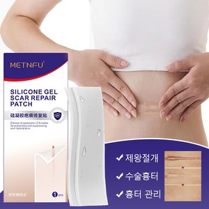 흉터 밴드 실리콘 젤시트 제왕절개 흉터 화상 수술 흉터, 1개, 1개