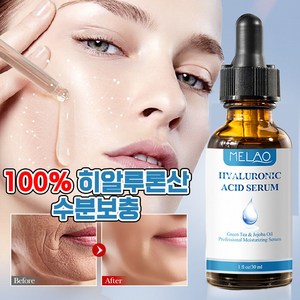 미국기술 1/1+1 저분자 히알루론산 모공 수축 앰플 주름개선 수분 보충 세럼, 1개, 30ml