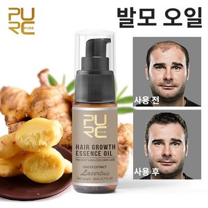 PURC 탈모 보습 성장 촉진에센스 탈모 모발 활력 증진 모낭, 1개, 20ml