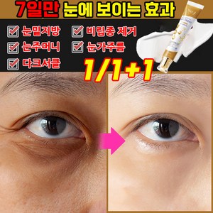 [빠른배송] 1+1/2+2 미국기술 눈 밑지방 비립종 제거 팔자 주름 목주름 눈밑주름 개선 크림, 1개, 30g