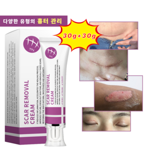 화상연고 상처 연고 켈로이드 욕창 찰과상 피부흉터 흉터 연고, 30ml, 2개