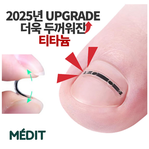 메딧트 티탄토우 내성발톱 교정 키트 셀프교정 내향성발톱 티타늄 관리 도구 세트, 50g, 1개, 1개입