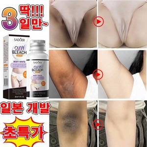 [일본 개발] 색소침착 미백 크림 겨드랑이 착색크림 멜라토닝 크림 사타구니 팔꿈치 엉덩이 비디미백 멜라닌 크림, 1개, 30ml