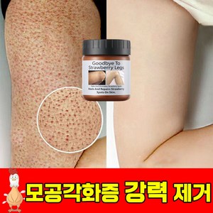 [빠른효과] 모공 각화증 닭살 피부 개선 부드러운 보습 바디 크림, 2개, 120g