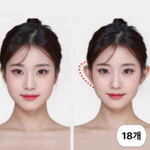 엔웨스트 엘프귀 누운귀 귀성형 테이프 스티커, 18개, 투명