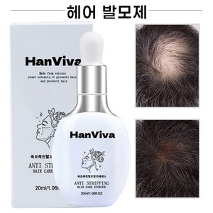 머리 카락 발모제 탈모 방지 모낭 성장 촉진 에센스 두피 케어 영양제 생강 하수오 당귀 측백엽 천연 식물 헤어 세럼, 1개, 20ml