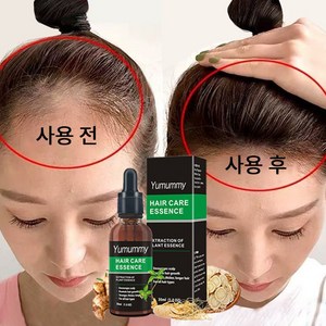 Hai Hai Gowe 두피 케어 세럼 발모제, 1개, 30ml