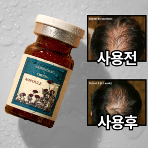 계림당 탈모앰플 두피 클리닉 헤어 완화 에센스, 10개, 5ml