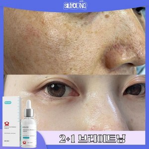 SILIYOUNG 2+1/3+2검버섯제거 잡티 멜라닌 색소침착 무자극 미백 기능성 잡티 나이아신아마이드 잡티 세럼 기미 미백 에센스 앰플, 1개, 30ml