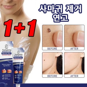 1+1 얼굴 사마귀 비립종제거 눈밑지방제거 크림 피부 리페어 크림, 2개, 20g