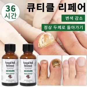 HEALMUSZ 발톱 무좀 앰플 네일 리페어 발톱 강화 발톱 영양제 문제성 발톱 케어 효과보장, 1개, 30ml