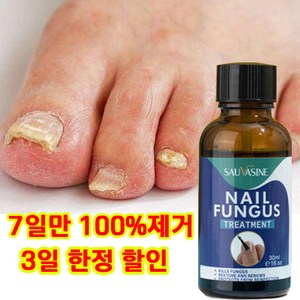 [100% 제거/국내배송] 손톱 발톱 리페어 에센스 발톱영양제 문제성발톱 앰플 발톱무좀 내성발톱, 1개, 30ml