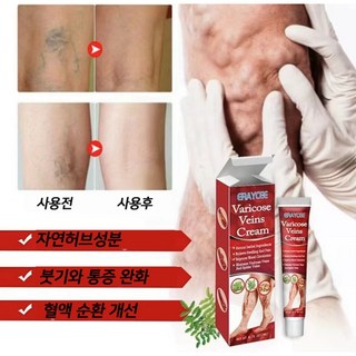 하지정맥류LK015 상세 정보